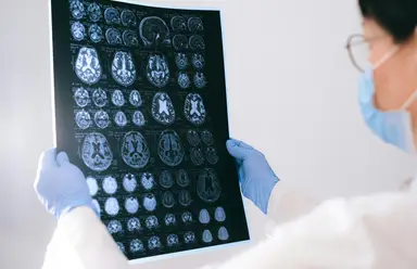 Proyecto POLARIS. Hombres y Mujeres: ¿Un Alzheimer diferente?