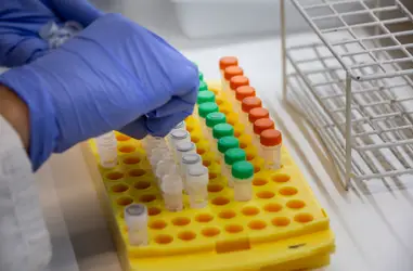 Investigación y sensibilización en salud cardiovascular de la mujer