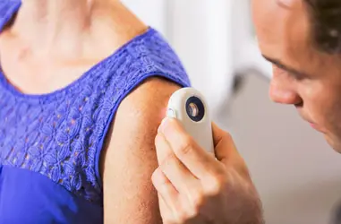 Investigación para el cáncer de piel