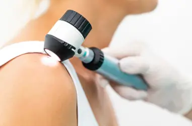 Médico examinando un lunar en el hombro de un paciente mediante un dermatoscopio manual