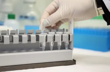 Biobanco para la investigación de las enfermedades raras