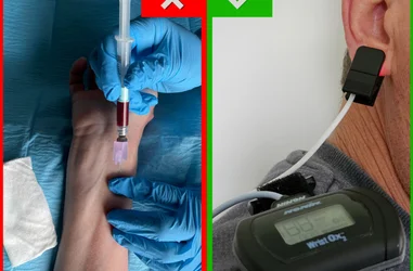 Atención óptima para personas con enfermedad respiratoria crónica.