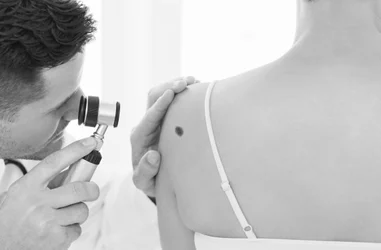 Investigación para el cáncer de piel