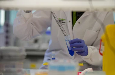 Investigación para la detección temprana del Alzheimer