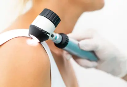 Médico examinando un lunar en el hombro de un paciente mediante un dermatoscopio manual