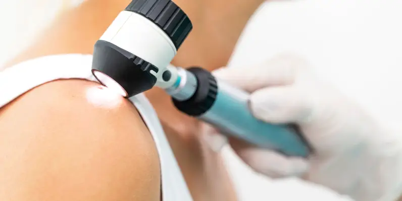 Médico examinando un lunar en el hombro de un paciente mediante un dermatoscopio manual